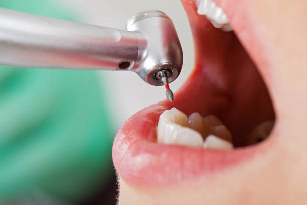 Best Emergency Gum Pain Relief  in Waterford, CA